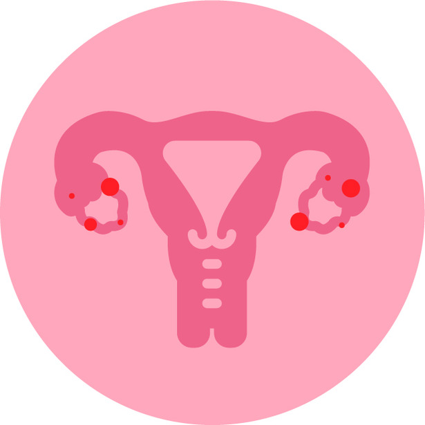 icono de endometriosis
